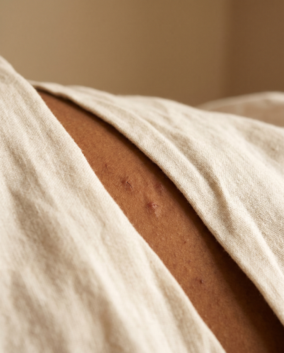 Layla · Tone V · Bikini line · Week 0 — abstract macro: skin texture with bumps peeking under draped beige linen